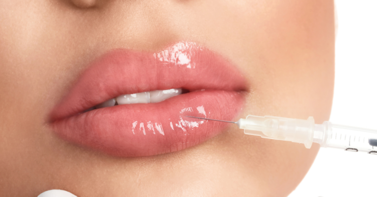 Is Lip Filler the Secret to Achieving the Perfect Pout?