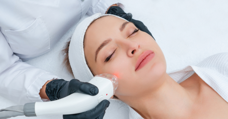 What Are the Benefits of Endolift Treatment for Facial Rejuvenation?