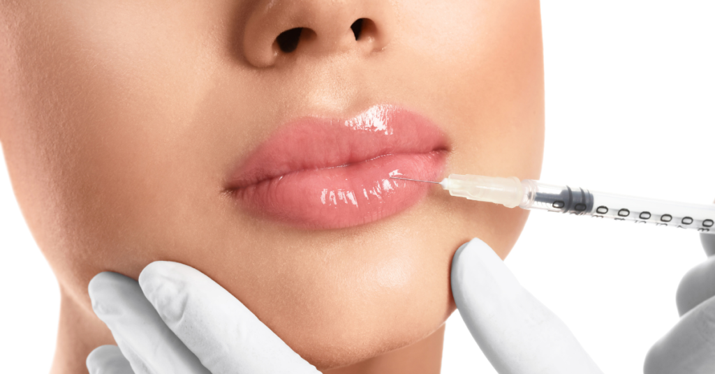 Is Lip Filler Safe? What Should You Consider Before Treatment?