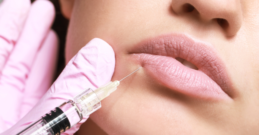 How Long Do Lip Fillers Last? What to Expect After Treatment?