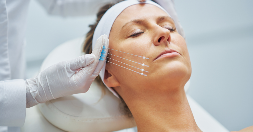 Is Endolift Treatment the Best Option for Non-Surgical Skin Tightening?